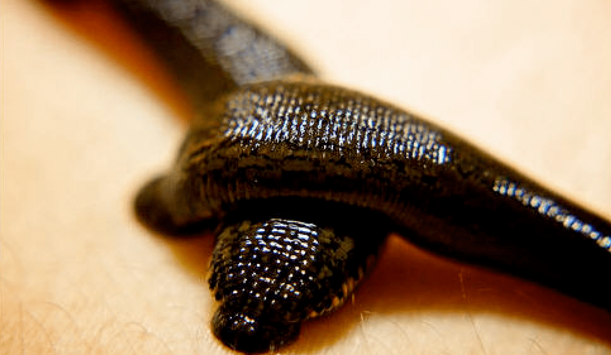 Leeches treat prostatitis