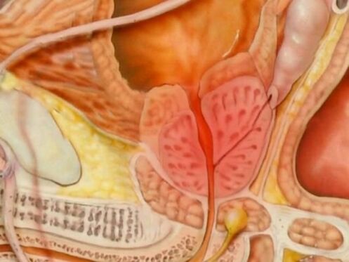 A person's healthy prostate type